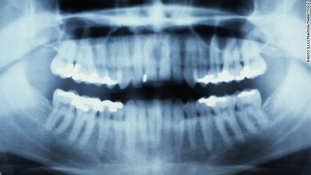Dental stem cells: Are baby teeth the next wave in biobanking?