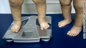 Obesity in the US Fast Facts