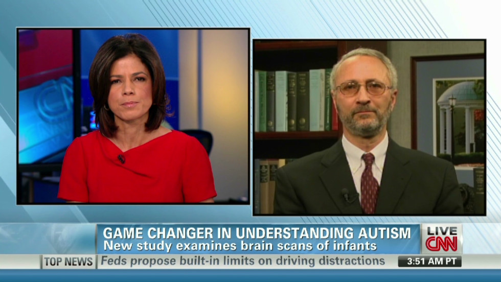 Autism predicted by infant brain changes, study says 
