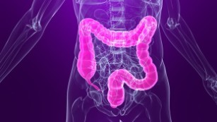 Be kind to your colon with less-invasive screenings, panel advises