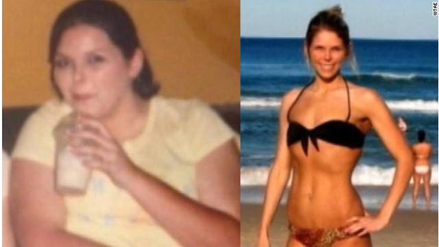 100 Pound Weight Loss Bikini Photos