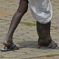 Every last worm: Eliminating Elephantiasis in India - CNN.com