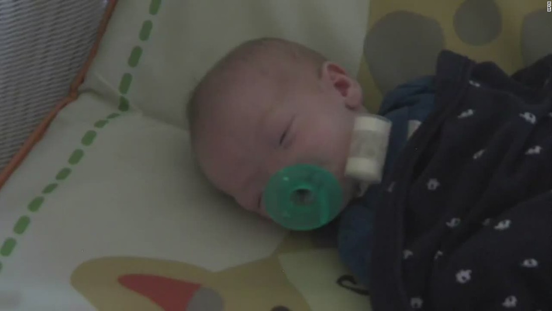 baby-born-without-nose-cnn-video