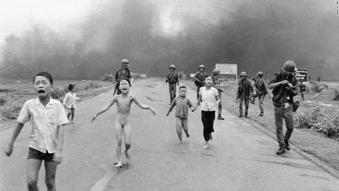 Image result for GIRL HIT BY NAPALM IN VIETNAM WAR