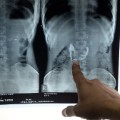 14 medical innovations x ray