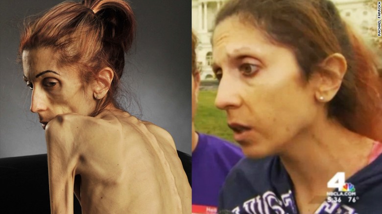 Rachel Farrokh dramatic transformation