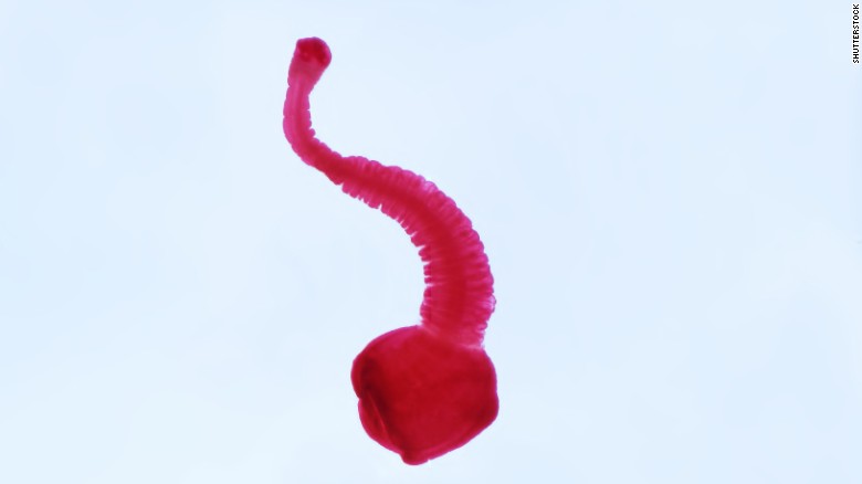 &amp;lt;strong&amp;gt;Tapeworm, aka Neurocysticercosis, aka T. solium:&amp;lt;/strong&amp;gt; This is Taenia solium, the pork tapeworm that causes one of the grossest diseases we&amp;#39;re heard about in a while. It&amp;#39;s responsible for the worst headache of Luis Ortiz&amp;#39;s life. &amp;lt;br /&amp;gt;When surgeons looked in his brain, they found a &amp;quot;wiggling&amp;quot; tapeworm inside a cyst. That&amp;#39;s called neurocysticercosis, and the Centers for Disease Control and Prevention says that about a 1,000 people a year get them from eating something infected with &amp;quot;microscopic eggs passed in the feces of a person who has an intestinal pork tapeworm.&amp;quot;