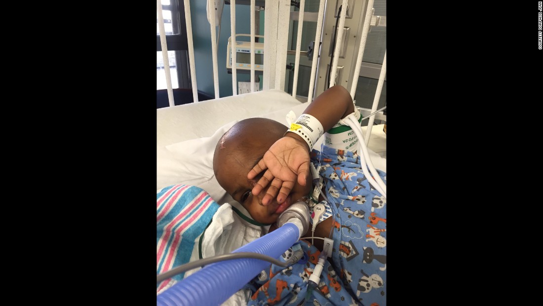 The rare recovery of toddler who shot himself in head
