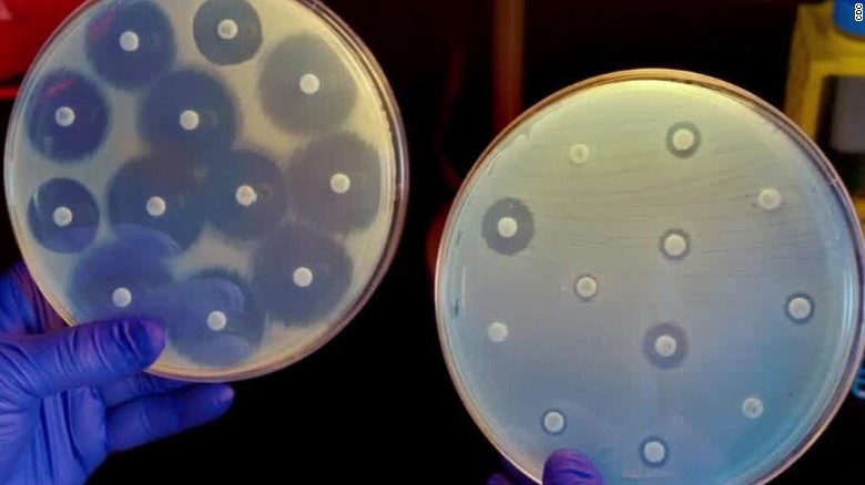 Drug Resistant Superbug May Be Craftier More Widespread