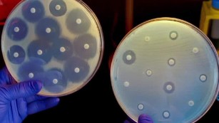 5 things you need to know about antimicrobial resistance