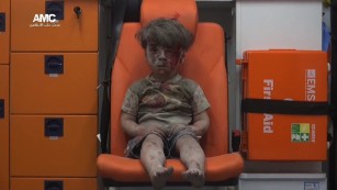 Little boy in Aleppo a vivid reminder of war&#39;s horror