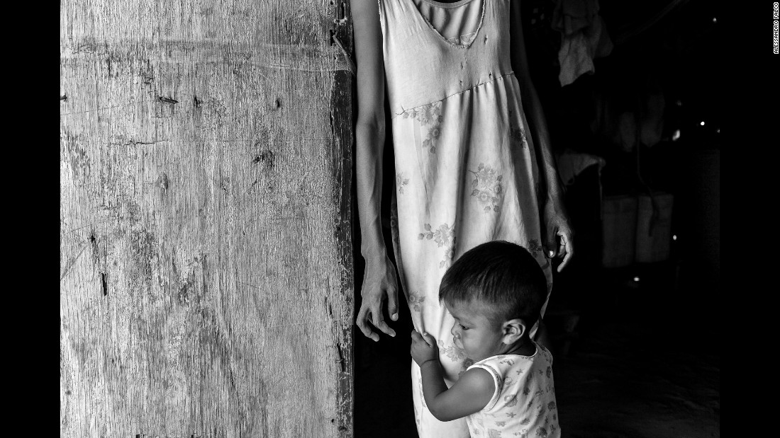 Josué David, 1 year old, tightens the dress of his mother Aura Rosa. She said she&#39;s not eating every day so she can feed him properly.