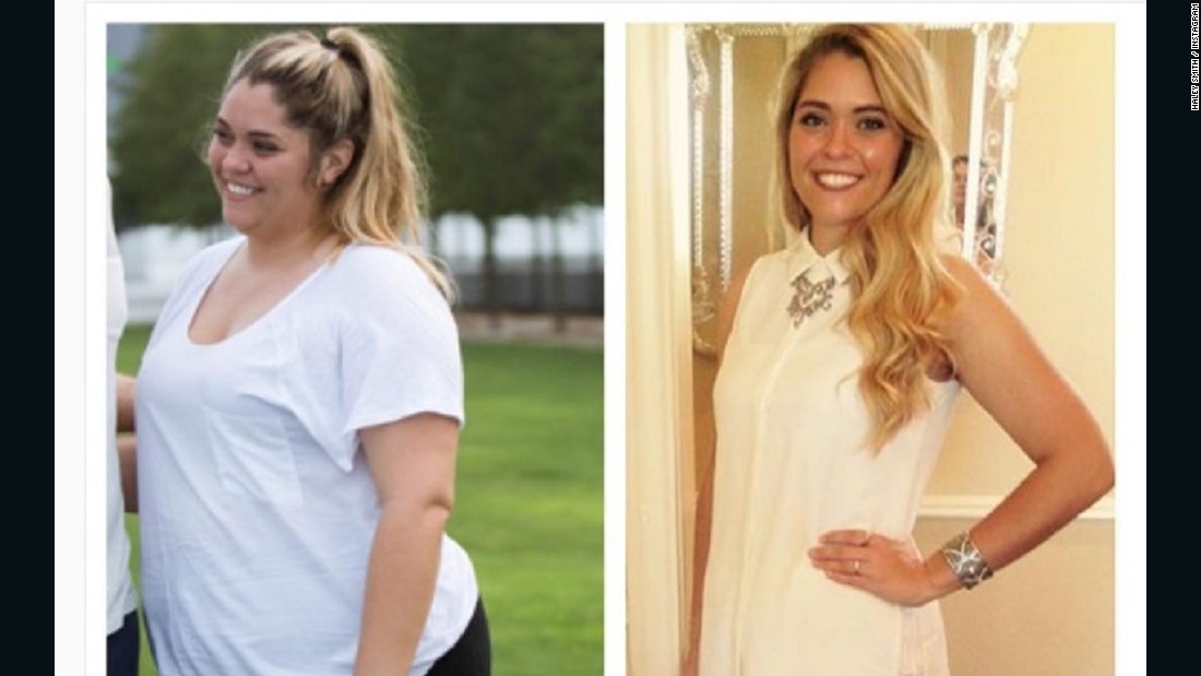 100 Pound Weight Loss And Lose Skin