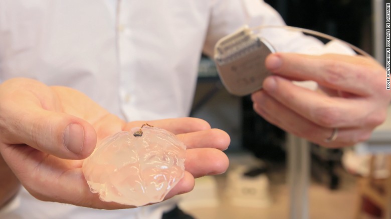 The implant consists of nearly 100 electrodes, surgically placed over the monkey&#39;s motor
cortex (here, a silicon model of a primate brain).