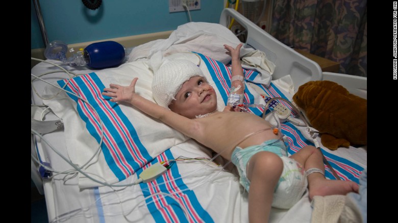 Jadon stretches his arms in his room within the hospital&#39;s pediatric intensive care unit. Anias rests in a nearby bed in the same room.