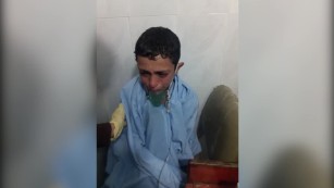 &#39;Will I die, miss?&#39; Terrified Syrian boy suffers suspected gas attack