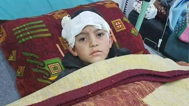 Abdel Basit Al-Satouf, 10, lost his mother and sister in the bombing, a monitoring group said.