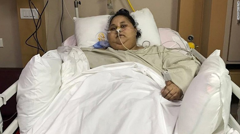 World S Heaviest Woman Smiling Again After Weight Reduction Surgery Cnn