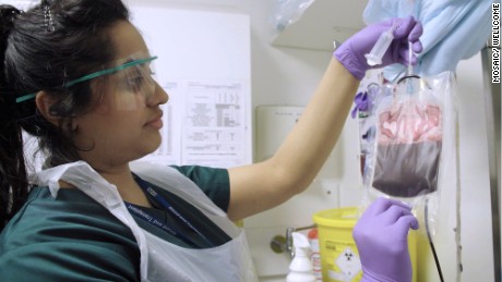 Blood extracted from an umbilical cord and placenta by a member of the Cord Bank Team at NHS Blood and Transplant.