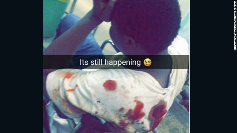 Nigerian students hospitalized in Mob attacks in India 