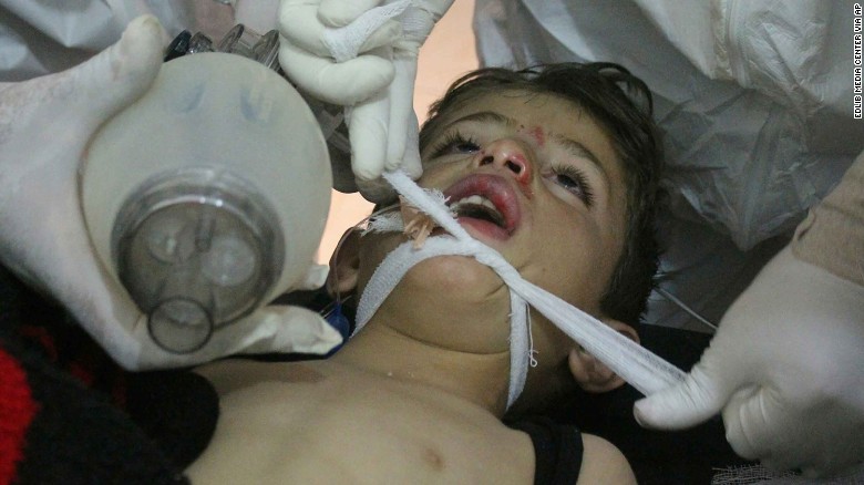 Syrian doctors treat a child following the suspected chemical attack Tuesday.