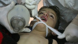 Syria attack photos show there is no hiding from horror