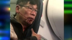 United passenger shown bleeding after incident