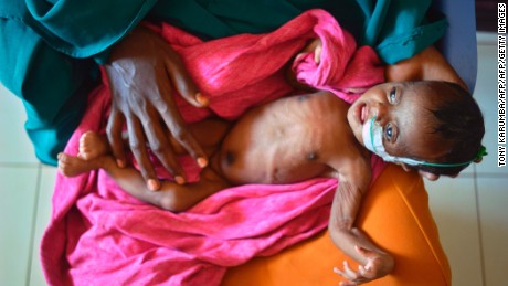 UNICEF: Time is running out to stop famine