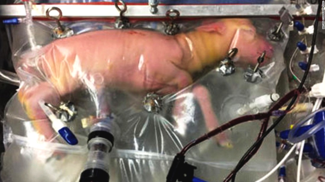 'Plastic bag' womb could help keep premature babies alive