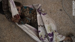 This injured girl was found by Iraqi forces as they &lt;a href=&quot;http://www.cnn.com/2017/06/29/middleeast/iraq-mosul-fighting/index.html&quot; target=&quot;_blank&quot;&gt;advanced against ISIS militants&lt;/a&gt; in the Old City of Mosul, Iraq, on Monday, July 3. She was carried away for medical assistance. Iraq&#39;s military is engaged in fierce street-to-street fighting for the&lt;a href=&quot;http://www.cnn.com/2017/06/30/middleeast/iraq-mosul-fighting/index.html&quot;&gt; final few blocks &lt;/a&gt;still under the terror group&#39;s control. The battle to reclaim Mosul, the last major ISIS stronghold in Iraq, has been underway since fall 2016.