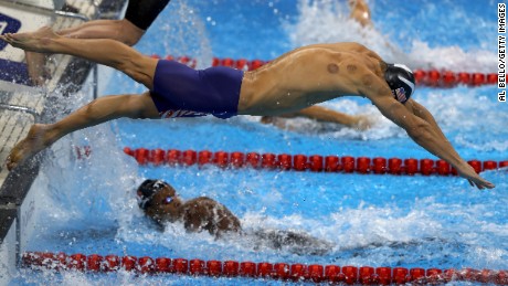 Olympics in bright red spots: What is cupping? - CNN