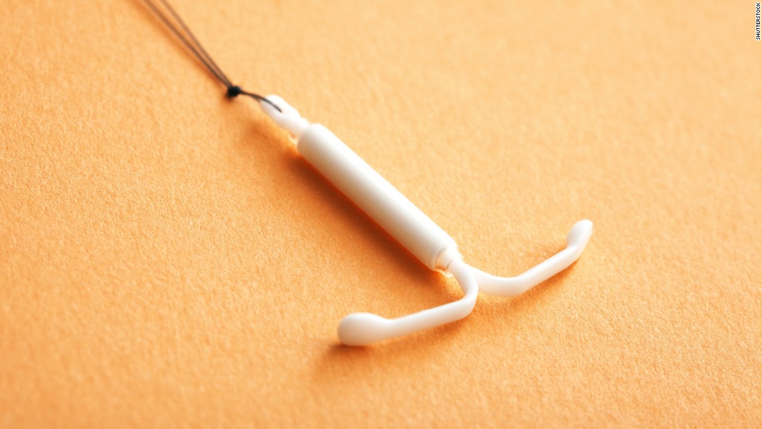Obamacare in jeopardy, states protect no-cost contraception, including vasectomy