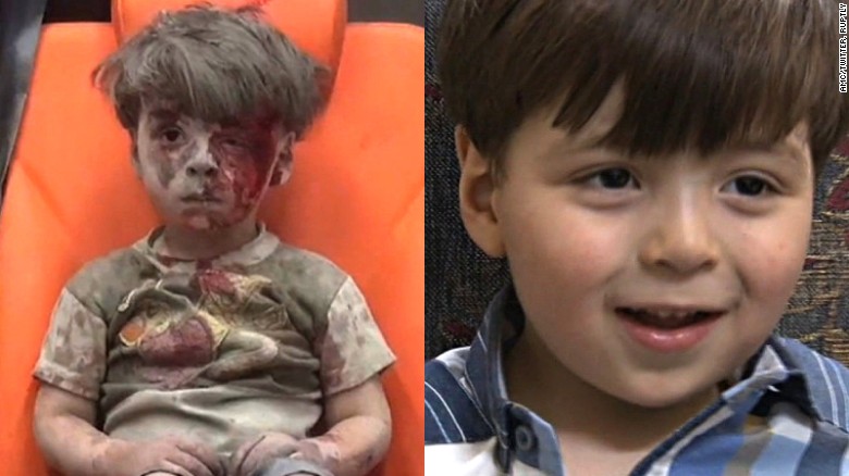 The image of Omran Daqneesh taken last August (left), and how he appeared in Syrian TV interviews.